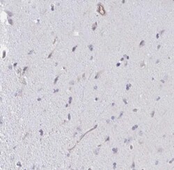 SHISA7 Antibody, Novus Biologicals 0.1mL; Unlabeled:Antibodies, Polyclonal