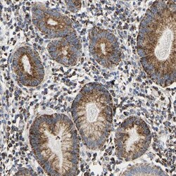 SHMT2 Antibody, Novus Biologicals 0.1mL; Unlabeled:Antibodies, Polyclonal