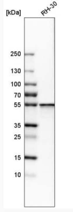 SHMT2 Antibody, Novus Biologicals 0.1mL; Unlabeled:Antibodies, Polyclonal