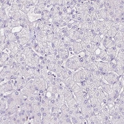 SI Sucrase-Isomaltase Antibody, Novus Biologicals 0.1mL; Unlabeled:Antibodies,