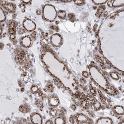 SIAE Antibody, Novus Biologicals:Antibodies:Primary Antibodies