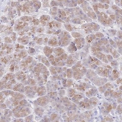 SIAH3 Antibody, Novus Biologicals 0.1mL; Unlabeled:Antibodies, Polyclonal