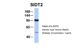 SIDT2 Antibody, Novus Biologicals 0.05mg; Unlabeled:Antibodies, Polyclonal