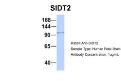 SIDT2 Antibody, Novus Biologicals 0.05mg; Unlabeled:Antibodies, Polyclonal