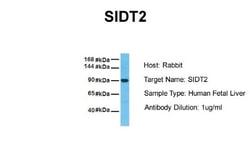 SIDT2 Antibody, Novus Biologicals 0.05mg; Unlabeled:Antibodies, Polyclonal