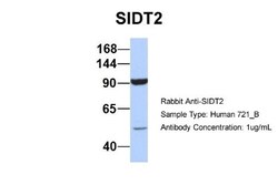 SIDT2 Antibody, Novus Biologicals 0.05mg; Unlabeled:Antibodies, Polyclonal