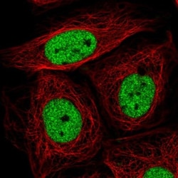 SIN3A Antibody, Novus Biologicals:Antibodies:Primary Antibodies
