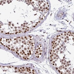 SIN3A Antibody, Novus Biologicals 0.1mL; Unlabeled:Antibodies, Polyclonal