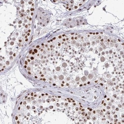 SIN3A Antibody, Novus Biologicals:Antibodies:Primary Antibodies