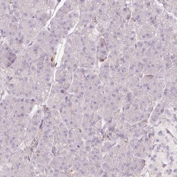 SIPA1 Antibody, Novus Biologicals 0.1mL; Unlabeled:Antibodies, Polyclonal