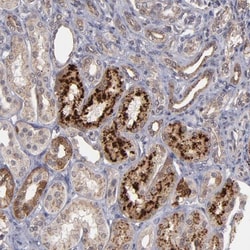 SIPA1L1 Antibody, Novus Biologicals:Antibodies:Primary Antibodies