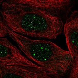 SIRPB2 Antibody, Novus Biologicals 0.1mL; Unlabeled:Antibodies, Polyclonal