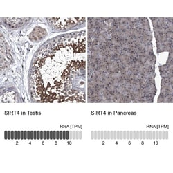SIRT4 Antibody, Novus Biologicals 25ul | Buy Online | Novus Biologicals | Fisher Scientific