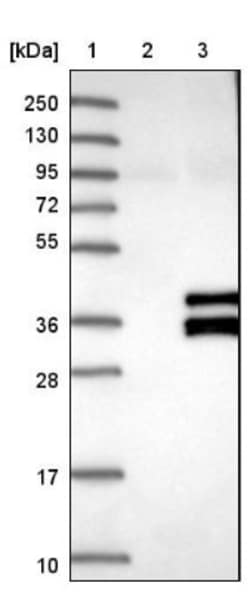 SIRT4 Antibody, Novus Biologicals 25ul | Buy Online | Novus Biologicals | Fisher Scientific