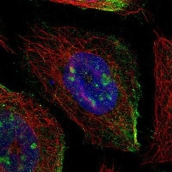 SIT1 Antibody, Novus Biologicals 25 &mu;L, Unlabeled:Antibodies, Polyclonal