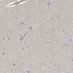 SIT1 Antibody, Novus Biologicals 25 &mu;L, Unlabeled:Antibodies, Polyclonal