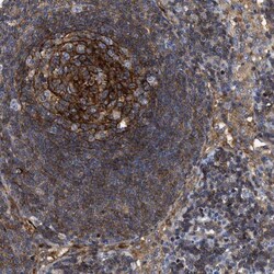 SIT1 Antibody, Novus Biologicals 25 &mu;L, Unlabeled:Antibodies, Polyclonal