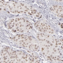 SIX1 Antibody, Novus Biologicals 25 &mu;L; Unlabeled:Antibodies, Polyclonal