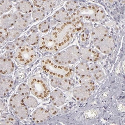 SIX1 Antibody, Novus Biologicals 25 &mu;L; Unlabeled:Antibodies, Polyclonal
