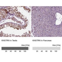 SKAP Antibody, Novus Biologicals:Antibodies:Primary Antibodies