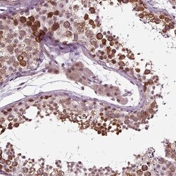 SKAP Antibody, Novus Biologicals:Antibodies:Primary Antibodies