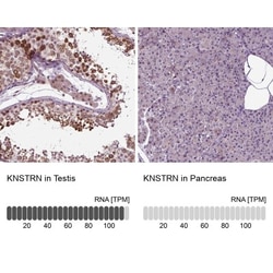 SKAP Antibody, Novus Biologicals:Antibodies:Primary Antibodies