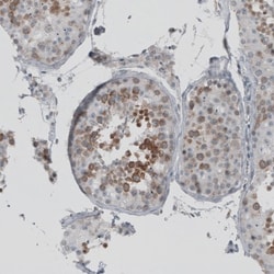 SKAP Antibody, Novus Biologicals:Antibodies:Primary Antibodies