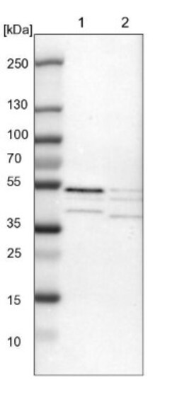 SKAR Antibody, Novus Biologicals 0.1mL; Unlabeled:Antibodies, Polyclonal