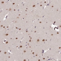 SKIV2L Antibody, Novus Biologicals 0.1mL; Unlabeled:Antibodies, Polyclonal