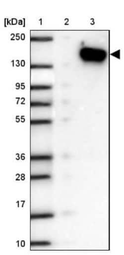 SKIV2L Antibody, Novus Biologicals 0.1mL; Unlabeled:Antibodies, Polyclonal