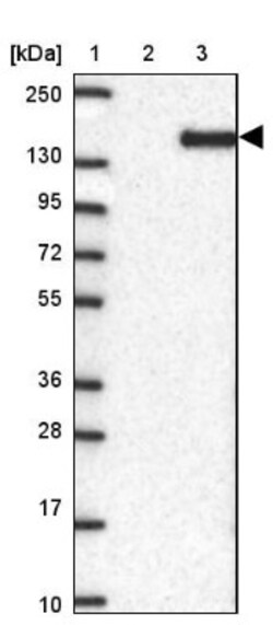 SKIV2L Antibody, Novus Biologicals 0.1mL; Unlabeled:Antibodies, Polyclonal