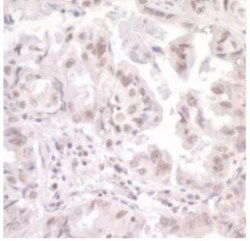 SKIV2L2 Antibody, R D Systems 0.1 mL | Buy Online | R&D Systems | Fisher Scientific