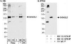 SKIV2L2 Antibody, R&D Systems&trade;