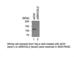 SKIV2L2 Antibody, R D Systems 0.1 mL | Buy Online | R&D Systems | Fisher Scientific