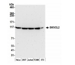 SKIV2L2 Antibody, R D Systems 0.1 mL | Buy Online | R&D Systems | Fisher Scientific