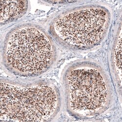SKOR2 Antibody, Novus Biologicals 25 &mu;L; Unconjugated:Antibodies, Polyclonal