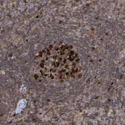 SLBP Antibody, Novus Biologicals 0.1mL; Unlabeled:Antibodies, Polyclonal
