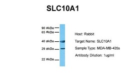 SLC10A1 Antibody, Novus Biologicals 0.05mg; Unlabeled:Antibodies, Polyclonal