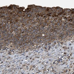 SLC10A3 Antibody, Novus Biologicals:Antibodies:Primary Antibodies