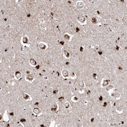 SLC10A4 Antibody, Novus Biologicals 25 &mu;L; Unlabeled:Antibodies, Polyclonal