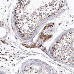 SLC10A4 Antibody, Novus Biologicals 25 &mu;L; Unlabeled:Antibodies, Polyclonal