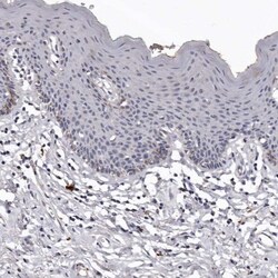 SLC10A4 Antibody, Novus Biologicals 25 &mu;L; Unlabeled:Antibodies, Polyclonal