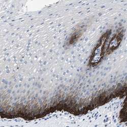SLC10A6 Antibody, Novus Biologicals 0.1mL; Unlabeled:Antibodies, Polyclonal