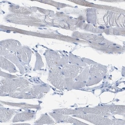 SLC10A6 Antibody, Novus Biologicals 0.1mL; Unlabeled:Antibodies, Polyclonal