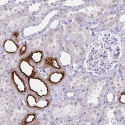 SLC12A3 Antibody, Novus Biologicals 0.1mL; Unlabeled:Antibodies, Polyclonal