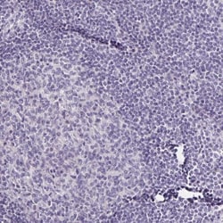 SLC12A3 Antibody, Novus Biologicals 0.1mL; Unlabeled:Antibodies, Polyclonal