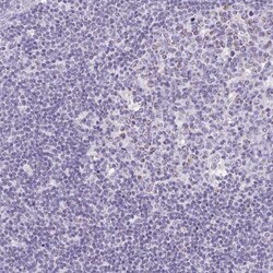 SLC13A1 Antibody, Novus Biologicals 0.1mL; Unlabeled:Antibodies, Polyclonal