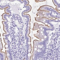 SLC13A2 Antibody, Novus Biologicals 0.1mL; Unlabeled:Antibodies, Polyclonal