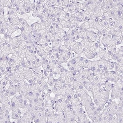 SLC13A2 Antibody, Novus Biologicals 0.1mL; Unlabeled:Antibodies, Polyclonal