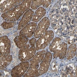 SLC13A3/NaDC3 Antibody, Novus Biologicals 0.1mL; Unlabeled:Antibodies,